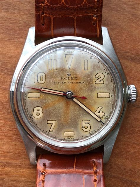 rolex watches radium.